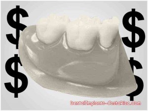 cost-of-partial-dental-plates